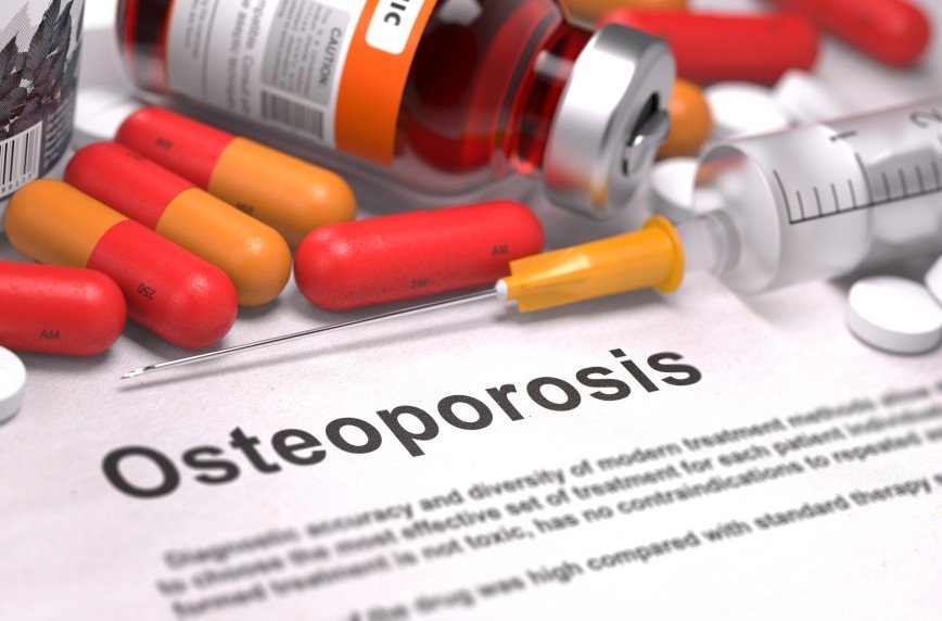 Россиянки все чаще болеют остеопорозом
